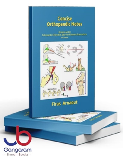 The Concise Orthopaedic Revision Notes Aid for FRCS and EBOT Examinations by Firas Arnaout