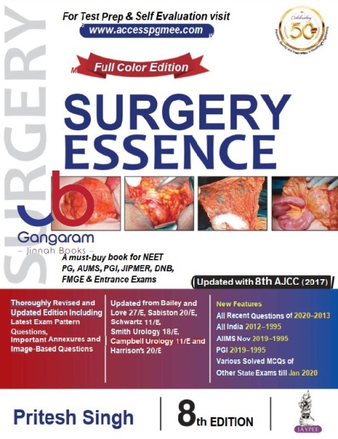 Surgery Essence 8th Edition