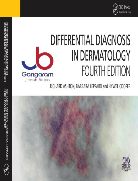 Differential Diagnosis in Dermatology 4th Edition