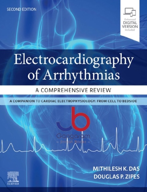 Electrocardiography of Arrhythmias A Comprehensive Review A Companion to Cardiac Electrophysiology 2nd Edition