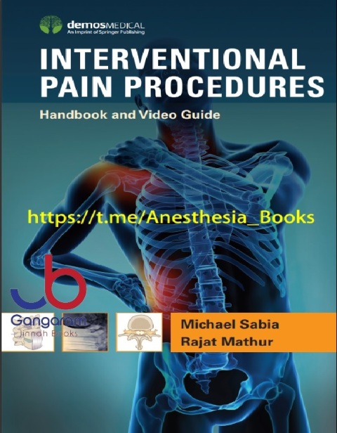 Interventional Pain Procedures Handbook and Video Guide 1st Edition
