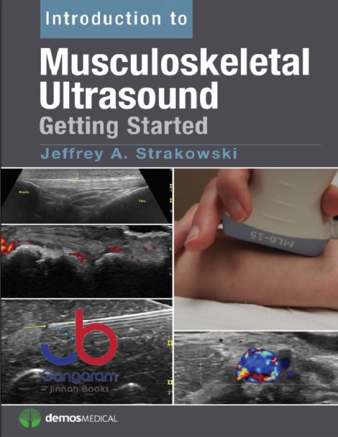 Introduction to Musculoskeletal Ultrasound Getting Started 1st Edition