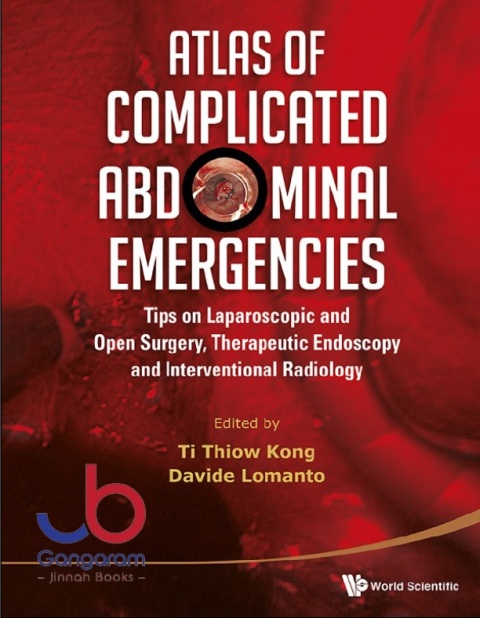 Atlas of Complicated Abdominal Emergencies Tips on Laparoscopic and Open Surgery, Therapeutic Endoscopy and Interventional Radiology