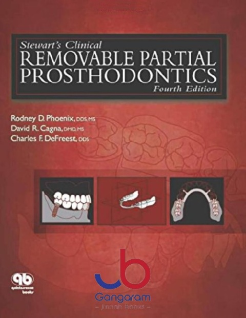 Stewart's Clinical Removable Partial Prosthodontics, 4th Edition
