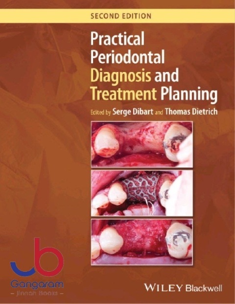 Practical Periodontal Diagnosis and Treatment Planning 2nd Edition