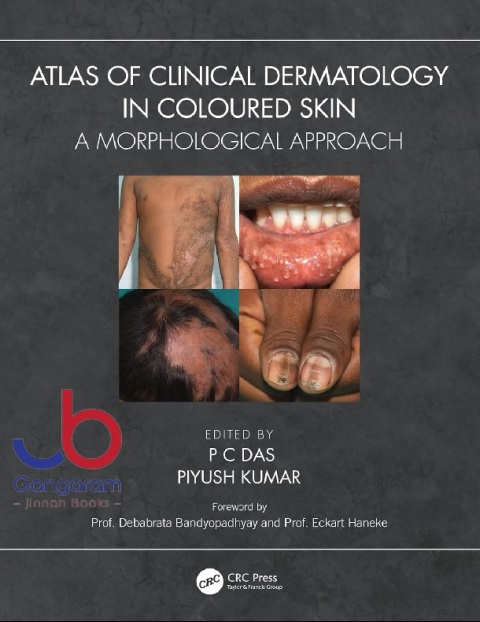 Atlas of Clinical Dermatology in Coloured Skin A Morphological Approach