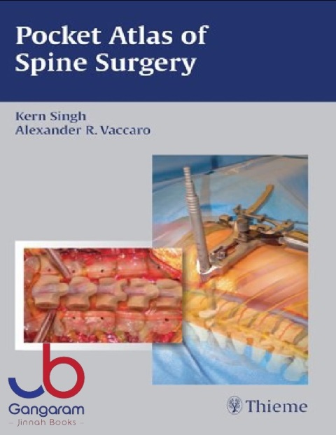 Pocket Atlas of Spine Surgery 1st Edition
