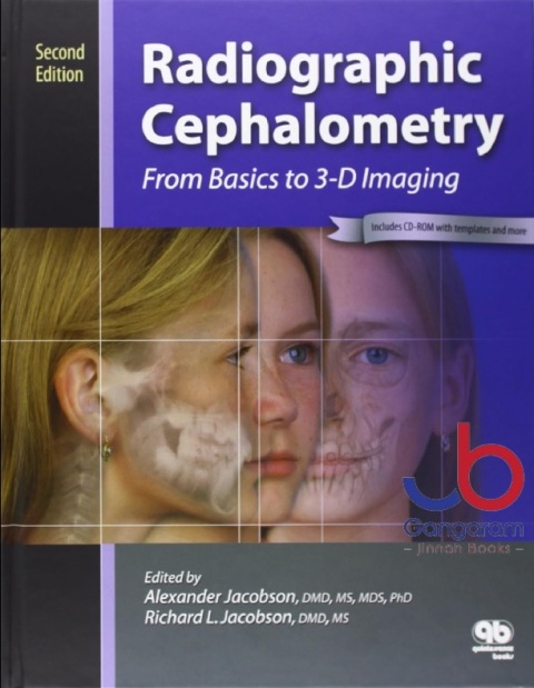 Radiographic Cephalometry From Basics to 3-d Imaging