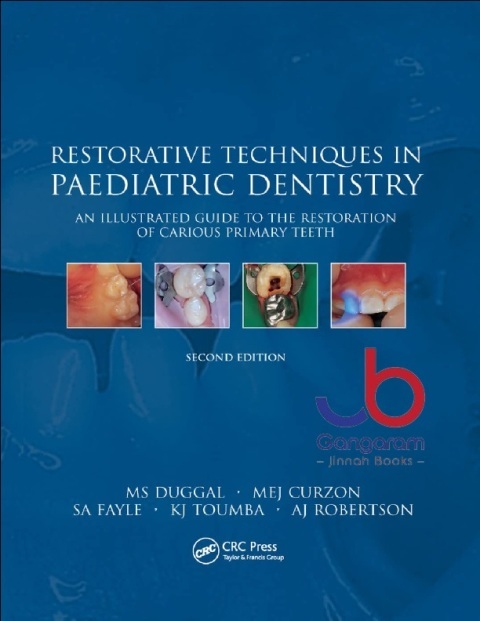 Restorative Techniques in Paediatric Dentistry An Illustrated Guide to the Restoration of Extensive Carious Primary Teeth