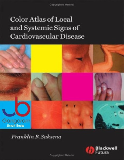 Color Atlas of Local and Systemic Manifestations of Cardiovascular Disease.