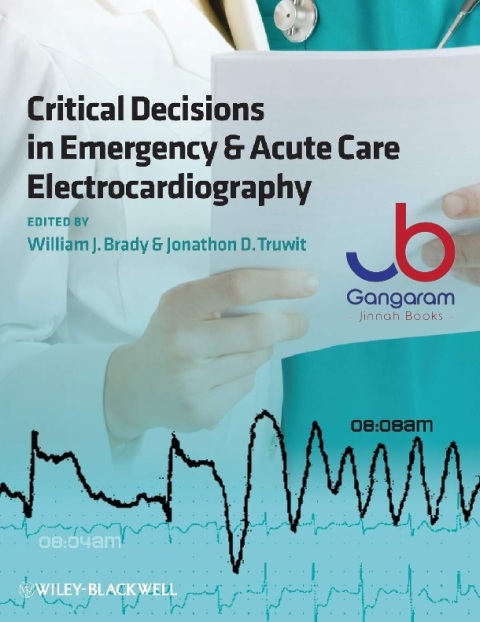 Critical Decisions in Emergency and Acute Care Electrocardiography