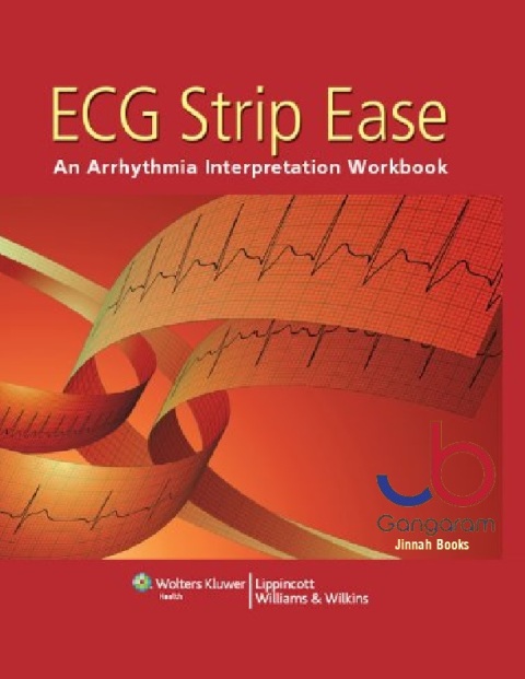 ECG Strip Ease An Arrhythmia Interpretation Workbook