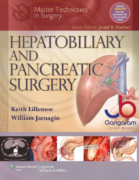 Master Techniques in Surgery Hepatobiliary and Pancreatic Surgery.