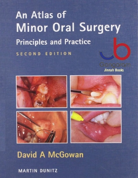 An Atlas of Minor Oral Surgery Principles and Practice