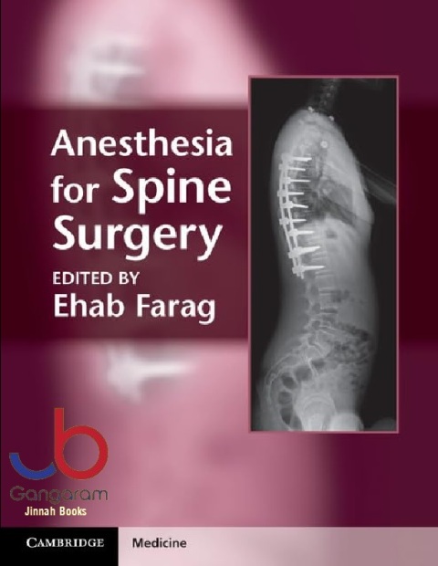 Anesthesia for Spine Surgery (Cambridge Medicine (Hardcover))