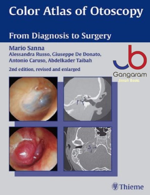 Color Atlas of Otoscopy From Diagnosis to Surgery
