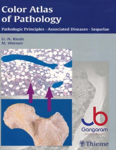 Color Atlas of Pathology Pathologic Principles-Associated Diseases-Sequela