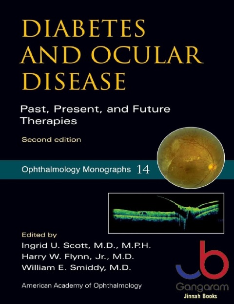 Diabetes and Ocular Disease Past, Present, and Future Therapies (American Academy of Ophthalmology Monograph Series)