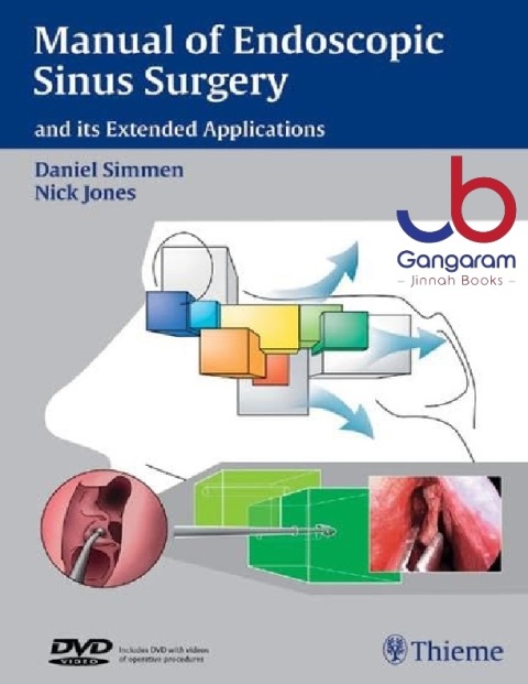 Endoscopic Sinus Surgery - And Extended Applications