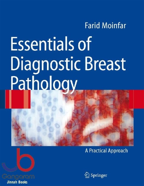 Essentials of Diagnostic Breast Pathology A Practical Approach