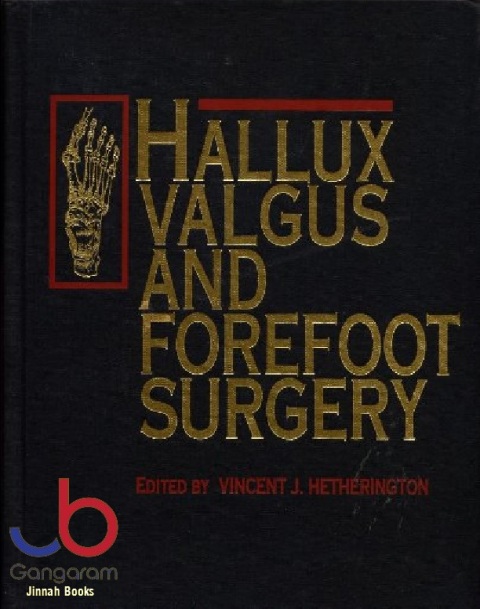Hallux Valgus and Forefoot Surgery
