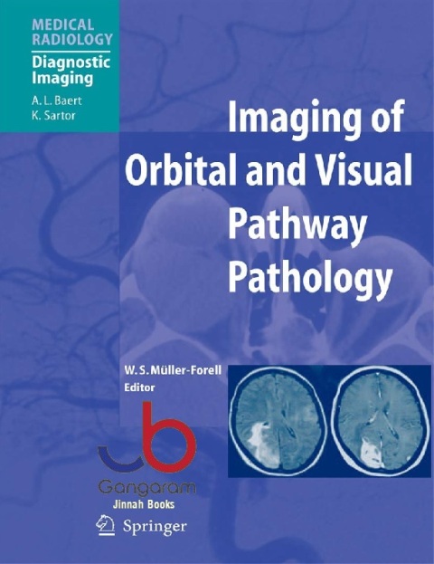 Imaging of Orbital and Visual Pathway Pathology (Medical Radiology)