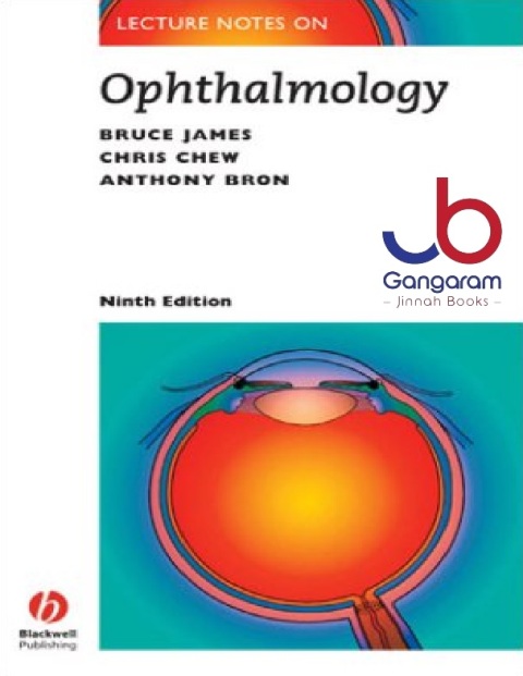 Lecture Notes on Ophthalmology