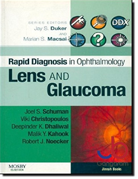 Lens and Glaucoma (Rapid Diagnoses in Ophthalmology Series)