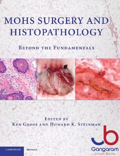Mohs Surgery and Histopathology Beyond the Fundamentals
