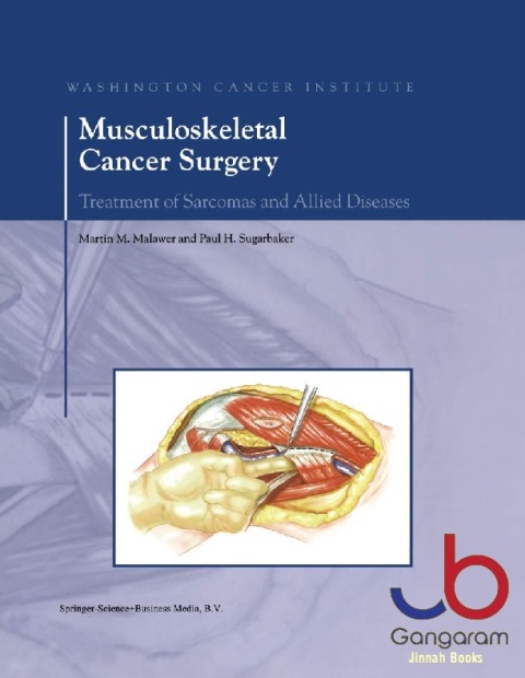 Musculoskeletal Cancer Surgery Treatment of Sarcomas and Allied Diseases