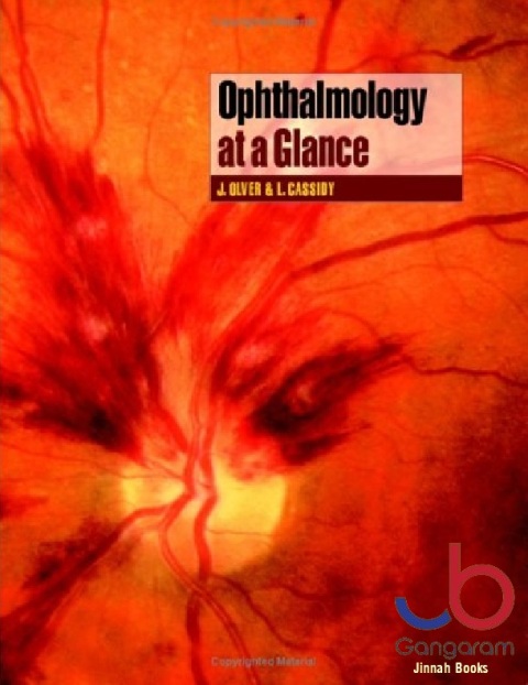 Ophthalmology at a Glance 1st Edition