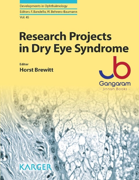 Research Projects in Dry Eye Syndrome (Developments in Ophthalmology Book 45)