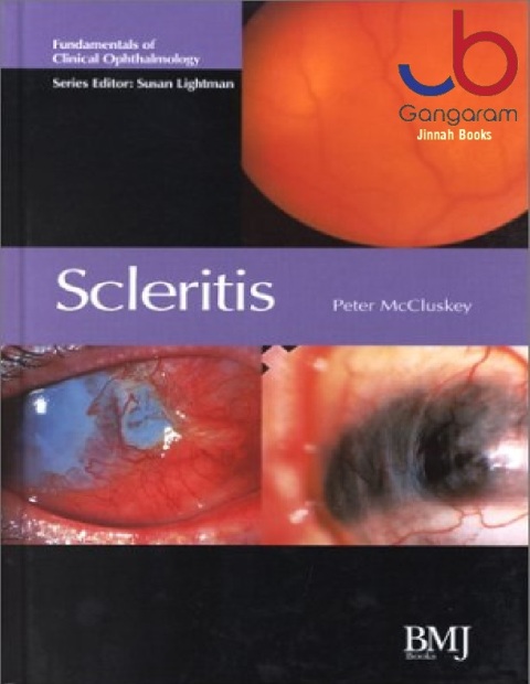 Scleritis Fundamentals of Clinical Ophthalmology (Fundamentals of Clinical Opthalmology)