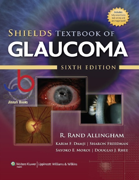 Shields Textbook of Glaucoma (Allingham, Shields' Textbook of Glaucoma)