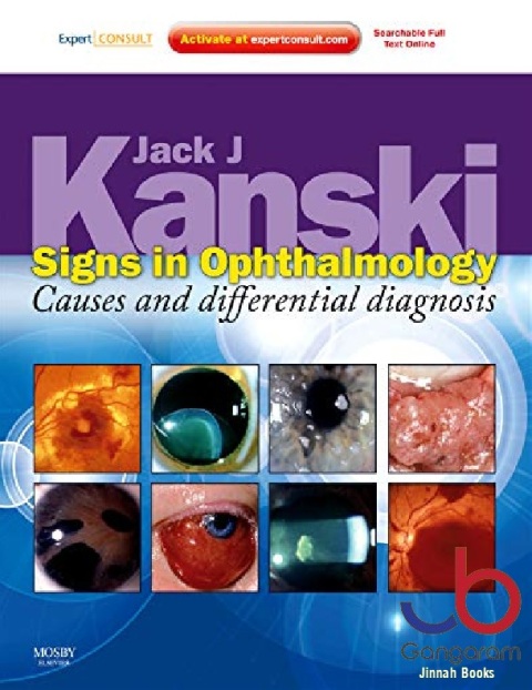Signs in Ophthalmology Causes and Differential Diagnosis Expert Consult - Online and Print