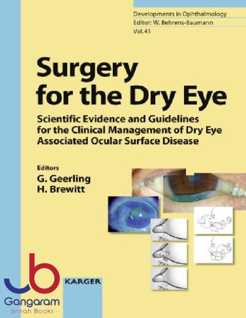 Surgery for the Dry Eye Scientific Evidence and Guidelines for the Clinical Management of Dry Eye Associated Ocular Surface Disease