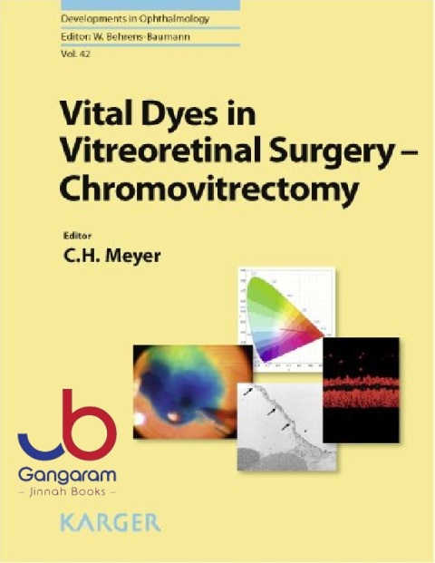 Vital Dyes in Vitreoretinal Surgery Chromovitrectomy (Developments in Ophthalmology, Vol. 42)