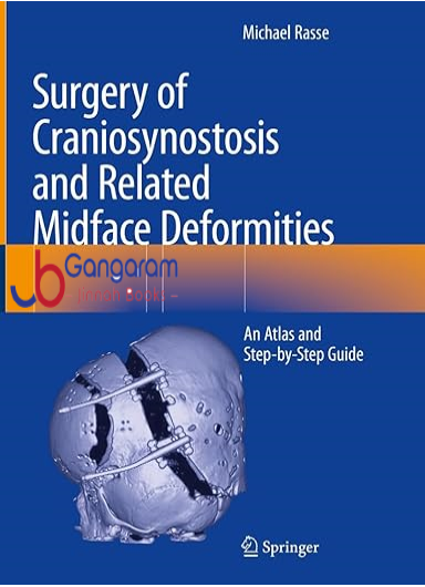 Surgery-of-Craniosynostosis-and-Related-Midface-Deformities-An-Atlas-and-Step-by-Step-Guide.